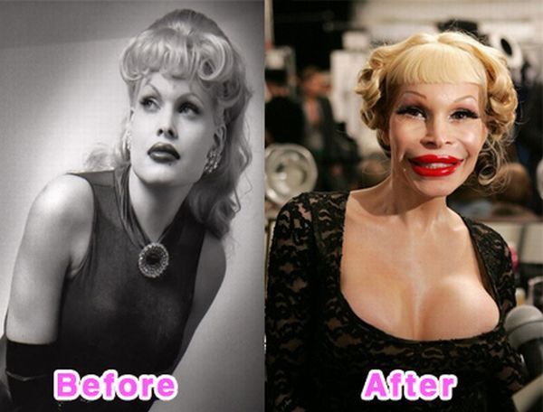 The Before and After Before and After... does it work?