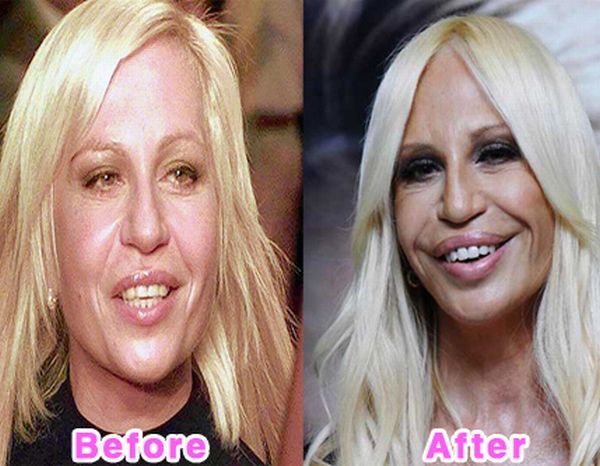 The Before and After Before and After... does it work?