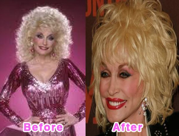 The Before and After Before and After... does it work?