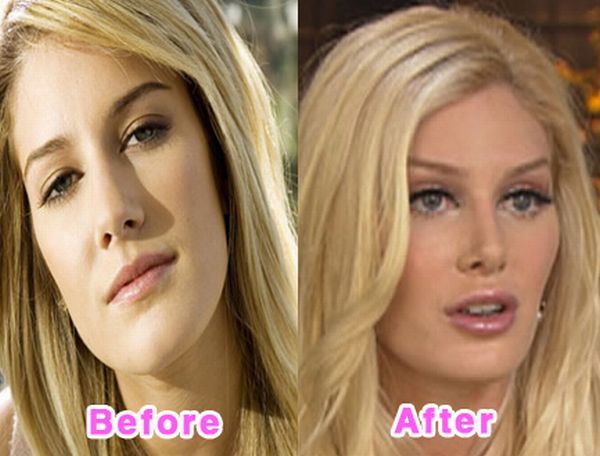 The Before and After Before and After... does it work?
