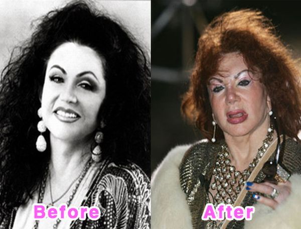 The Before and After Before and After... does it work?
