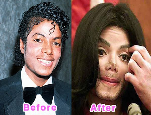 The Before and After Before and After... does it work?